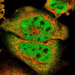 MEIS2 Antibody, Novus Biologicals 0.1mL; Unlabeled:Antibodies, Polyclonal